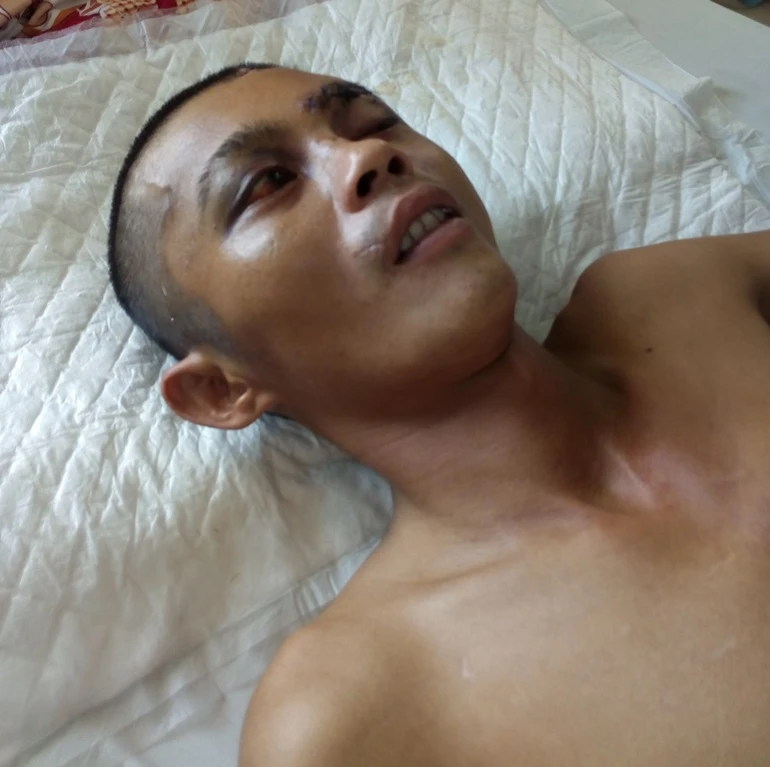 Bị tai nạn rất cần sự giúp đỡ